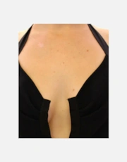Thumbnail 2 of 6